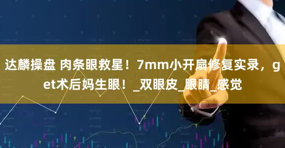 达麟操盘 肉条眼救星！7mm小开扇修复实录，get术后妈生眼！_双眼皮_眼睛_感觉