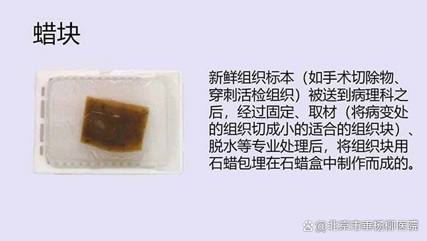 振兴配资 病理科的“神秘语言”